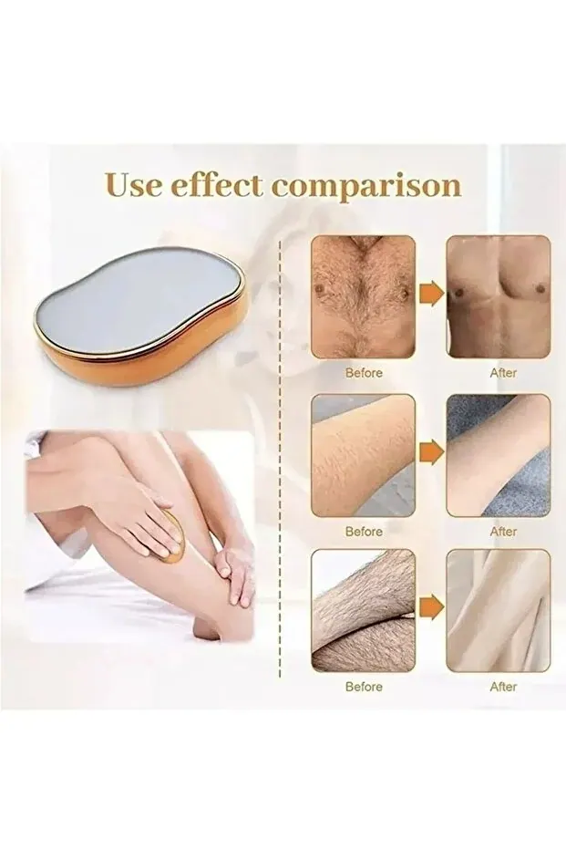 BEYZANA Crystal Eraser Epilasyon Aleti Tüy Silgisi Tüy Alıcı Fiziksel Kristal Epilatör - görsel 2